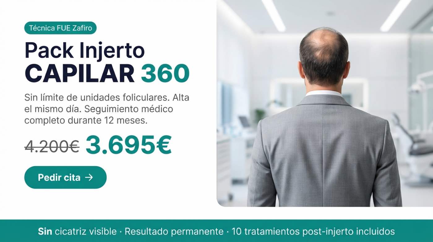 Promoci&oacute;n Pack Injerto Capilar 360 en Madrid &mdash; 3.695&euro;